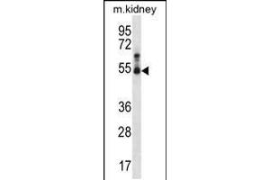 Western blot analysis in mouse kidney tissue lysates (35ug/lane).