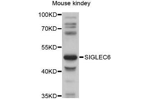 Western blot analysis of extracts of mouse kidney, using SIGLEC6 antibody (ABIN6292272) at 1:1000 dilution. (SIGLEC6 anticorps)