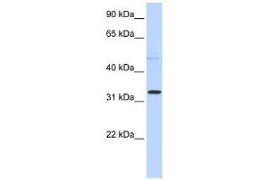 NEU4 antibody used at 1 ug/ml to detect target protein. (Sialidase 4 anticorps  (N-Term))