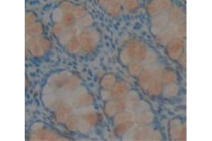 IHC-P analysis of Human Tissue, with DAB staining. (RETNLB anticorps  (AA 24-111))