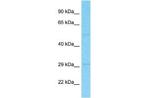 Host:  Rabbit  Target Name:  SLC22A15  Sample Type:  Stomach Tumor lysates  Antibody Dilution:  1. (SLC22A15 anticorps  (N-Term))