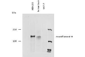 anti-Neurofilament, Heavy Polypeptide (NEFH) antibody