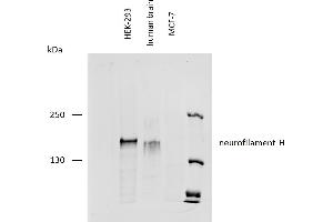 Western blotting analysis of human neurofilament H protein using mouse monoclonal antibody NF-01 on lysates of HEK-293 cell line, human brain lysate, and MCF-7 cell line (neurofilament non-expressing cell line, negative control) under reducing conditions. (NEFH anticorps)