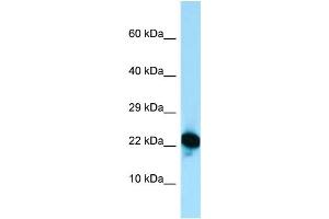 Host: Rabbit Target Name: RPL18A Sample Type: Jurkat Whole Cell lysates Antibody Dilution: 1. (RPL18A anticorps  (C-Term))