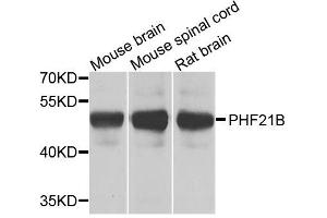 Western blot analysis of extracts of various cell lines, using PHF21B antibody. (PHF21B anticorps  (AA 322-531))