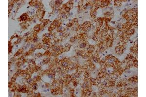 IHC image of ABIN7127355 diluted at 1:100 and staining in paraffin-embedded human liver tissue performed on a Leica BondTM system. (Recombinant ATP5B anticorps)