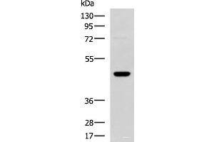 Western blot analysis of TM4 cell lysate using DNAJA4 Polyclonal Antibody at dilution of 1:800 (DNAJA4 anticorps)