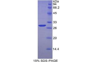 SDS-PAGE analysis of Mouse MYH4 Protein.
