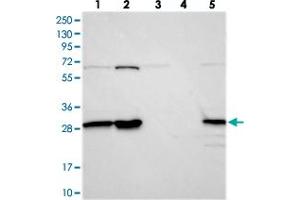 Western blot analysis of Lane 1: RT-4, Lane 2: U-251 MG, Lane 3: Human Plasma, Lane 4: Liver, Lane 5: Tonsil with INO80E polyclonal antibody  at 1:250-1:500 dilution. (INO80E anticorps)