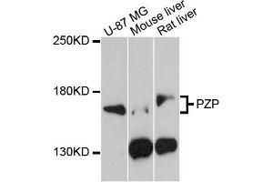 Western blot analysis of extracts of various cell lines, using PZP antibody (ABIN5971715) at 1:3000 dilution. (PZP anticorps)