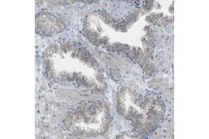 Immunohistochemical staining of human prostate with ZNF516 polyclonal antibody  shows granular cytoplasmic positivity in glandular cells. (ZNF516 anticorps)