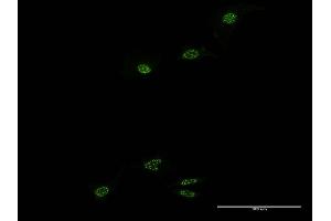 Immunofluorescence of monoclonal antibody to NR1D1 on HeLa cell. (NR1D1 anticorps  (AA 233-322))