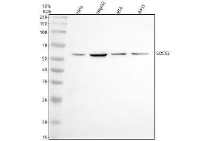 Western blot analysis of SOCS7 using anti-SOCS7 antibody (ABIN7606343).