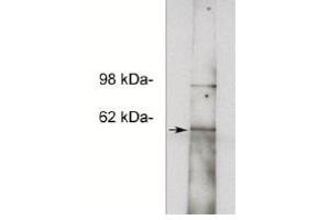 Image no. 1 for anti-Notum Pectinacetylesterase Homolog (NOTUM) antibody (ABIN265168) (NOTUM anticorps)