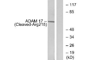 Western blot analysis of extracts from rat liver cells, using ADAM 17 (Cleaved-Arg215) antibody. (ADAM17 anticorps  (Cleaved-Arg215))