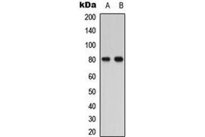 Western blot analysis of PTHR1 expression in HEK293T (A), COLO205 (B) whole cell lysates. (PTH1R anticorps  (Center))