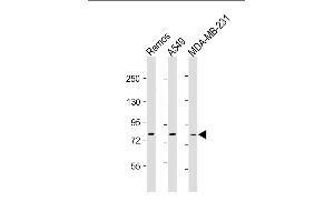All lanes : Anti-TLR2 Antibody at 1:500-1:1000 dilution Lane 1: Ramos whole cell lysate Lane 2: A549 whole cell lysate Lane 3: MDA-MB-231 whole cell lysate Lysates/proteins at 20 μg per lane. (TLR2 anticorps)