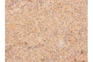 Figure. (TPSAB1 anticorps  (AA 161-262))