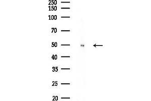 anti-Protein Phosphatase, Mg2+/Mn2+ Dependent, 1L (PPM1L) (Internal Region) antibody