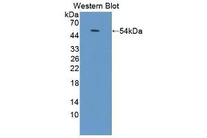 Western blot analysis of the recombinant protein. (ADCY9 anticorps  (AA 852-1065))