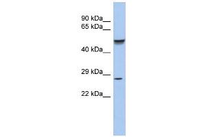WB Suggested Anti-PHOX2A Antibody Titration:  0. (PHOX2A anticorps  (N-Term))