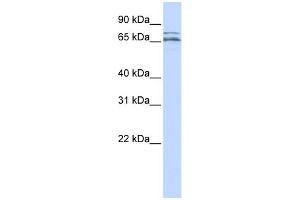 WB Suggested Anti-CACNB2 Antibody Titration:  0. (CACNB2 anticorps  (Middle Region))