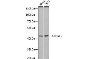 Western blot analysis of extracts of various cell lines, using CSNK1E antibody (ABIN6128970, ABIN6139116, ABIN6139117 and ABIN7101448) at 1:1000 dilution. (CK1 epsilon anticorps  (AA 247-416))