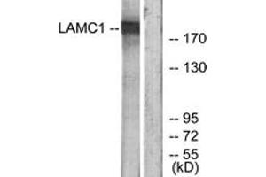 Western Blotting (WB) image for anti-Laminin, gamma 1 (LAMC1) (AA 1451-1500) antibody (ABIN2890005) (Laminin gamma 1 anticorps  (AA 1451-1500))