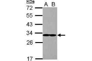 Image no. 2 for anti-Eukaryotic Translation Initiation Factor 2B, Subunit 1 Alpha, 26kDa (EIF2B1) (AA 1-305) antibody (ABIN1497966) (EIF2B1 anticorps  (AA 1-305))