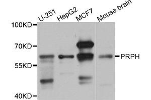 Western blot analysis of extracts of various cell lines, using PRPH antibody. (Peripherin anticorps)