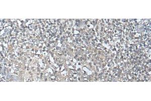 Immunohistochemistry of paraffin-embedded Human tonsil tissue using MEF2D Polyclonal Antibody at dilution of 1:50(x200)