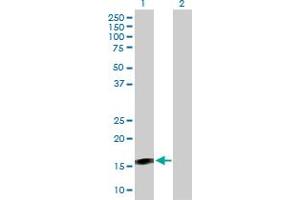 Western Blot analysis of BST2 expression in transfected 293T cell line by BST2 MaxPab polyclonal antibody. (BST2 anticorps  (AA 40-180))
