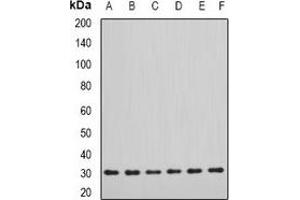 Western blot analysis of DDAH2 expression in SW620 (A), MCF7 (B), mouse lung (C), mouse kidney (D), rat heart (E), rat brain (F) whole cell lysates. (DDAH2 anticorps)