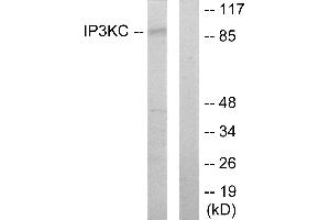 Western blot analysis of extracts from HT-29 cells, using IP3KC antibody. (ITPKC anticorps)