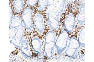 Immunohistochemistry (IHC) image for anti-CD38 (AA 43-300) antibody (ABIN7453961) (Recombinant CD38 anticorps  (AA 43-300))
