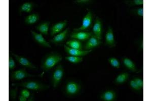 Immunofluorescence staining of A549 cells with ABIN7169072 at 1:166, counter-stained with DAPI.