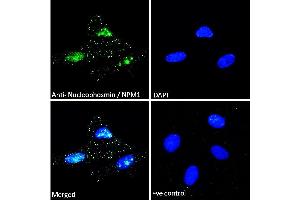 ABIN185372 Immunofluorescence analysis of paraformaldehyde fixed HeLa cells, permeabilized with 0.