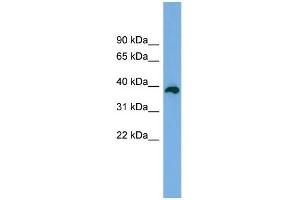 WB Suggested Anti-DEDD2 Antibody Titration: 0. (DEDD2 anticorps  (Middle Region))