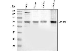 Western blot analysis of ATF2 using anti-ATF2 antibody (ABIN3043791).