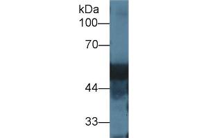 Western blot analysis of Rat Liver lysate, using Rat DBP Antibody (1 µg/ml) and HRP-conjugated Goat Anti-Rabbit antibody ( (Vitamin D-Binding Protein anticorps  (AA 395-475))