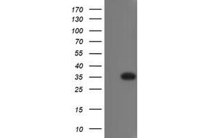 Image no. 1 for anti-RING1 and YY1 Binding Protein (RYBP) antibody (ABIN1500776) (RYBP anticorps)