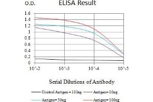 Black line: Control Antigen (100 ng),Purple line: Antigen (10 ng), Blue line: Antigen (50 ng), Red line:Antigen (100 ng)