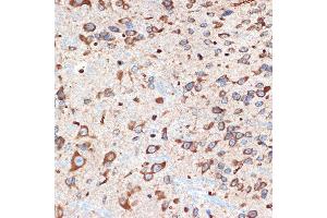 Immunohistochemistry of paraffin-embedded mouse spinal cord using  Rabbit mAb (ABIN7265453) at dilution of 1:100 (40x lens).