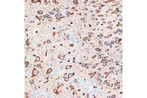 Immunohistochemistry of paraffin-embedded mouse spinal cord using  Rabbit mAb (ABIN7265453) at dilution of 1:100 (40x lens). (ADORA1 anticorps)