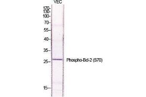 Western Blot (WB) analysis of specific cells using Phospho-Bcl-2 (S70) Polyclonal Antibody. (Bcl-2 anticorps  (pSer70))