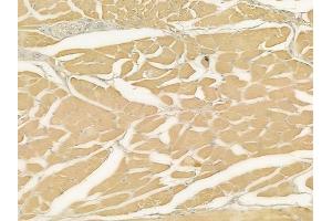 ABIN6262131 and ABIN6272645 at 1/100 staining human tongue carcinoma by IHC-P.