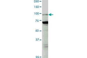 PCAF monoclonal antibody (M04), clone 5E11. (KAT2B anticorps  (AA 353-452))