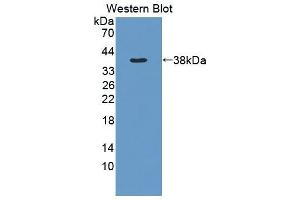 Detection of Recombinant MMP1, Rat using Polyclonal Antibody to Matrix Metalloproteinase 1 (MMP1)