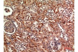 Immunohistochemistry (IHC) analysis of paraffin-embedded Human Kidney, antibody was diluted at 1:100. (CER1 anticorps  (Internal Region))