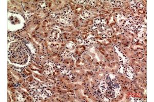 Immunohistochemistry (IHC) analysis of paraffin-embedded Human Kidney, antibody was diluted at 1:100.